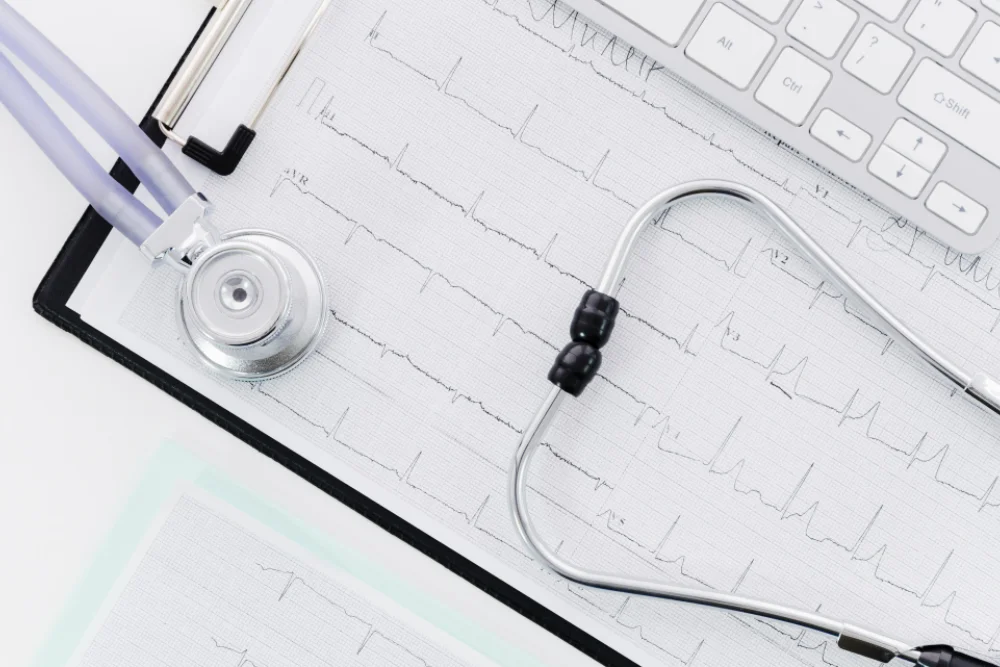 Eletrocardiograma
